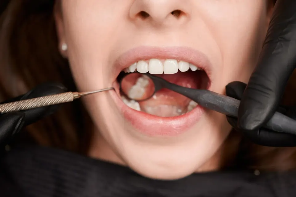 Dr. Shachi Shah placing tooth-colored filling at Enclave Dental in Lake Mary