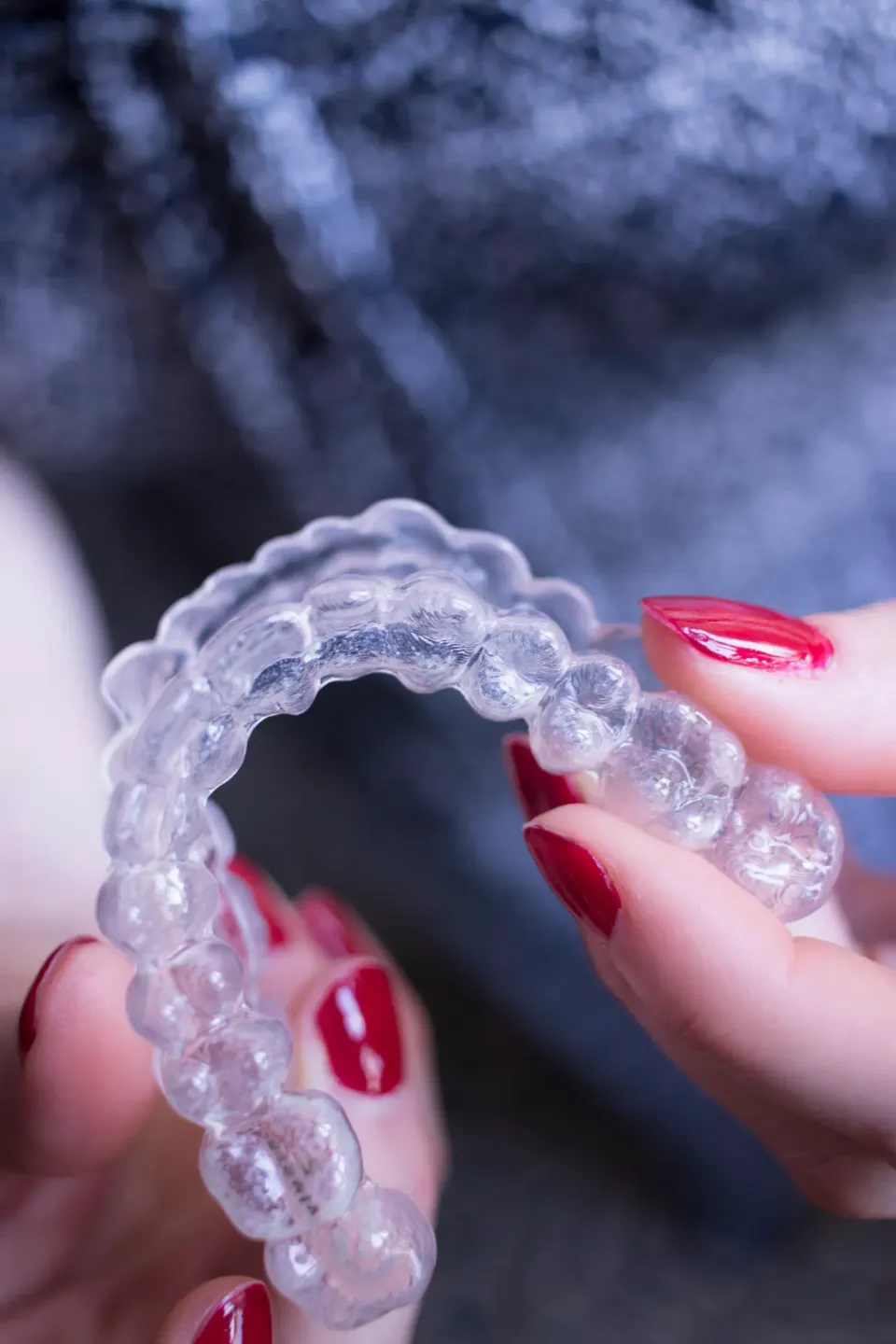 Custom night guard appliance on dental model at Enclave Dental Lake Mary