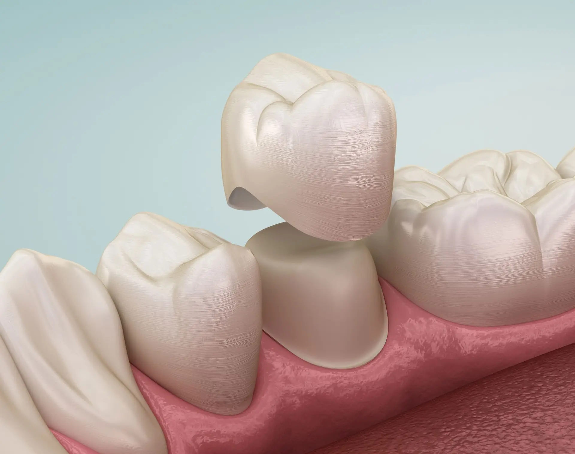 Patient receiving dental crown consultation at Enclave Dental in Lake Mary FL