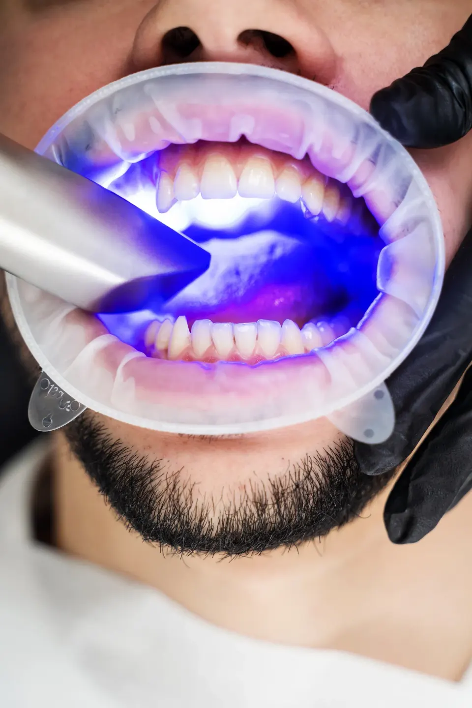 Happy patient smiling confidently after professional teeth whitening at Enclave Dental Lake Mary