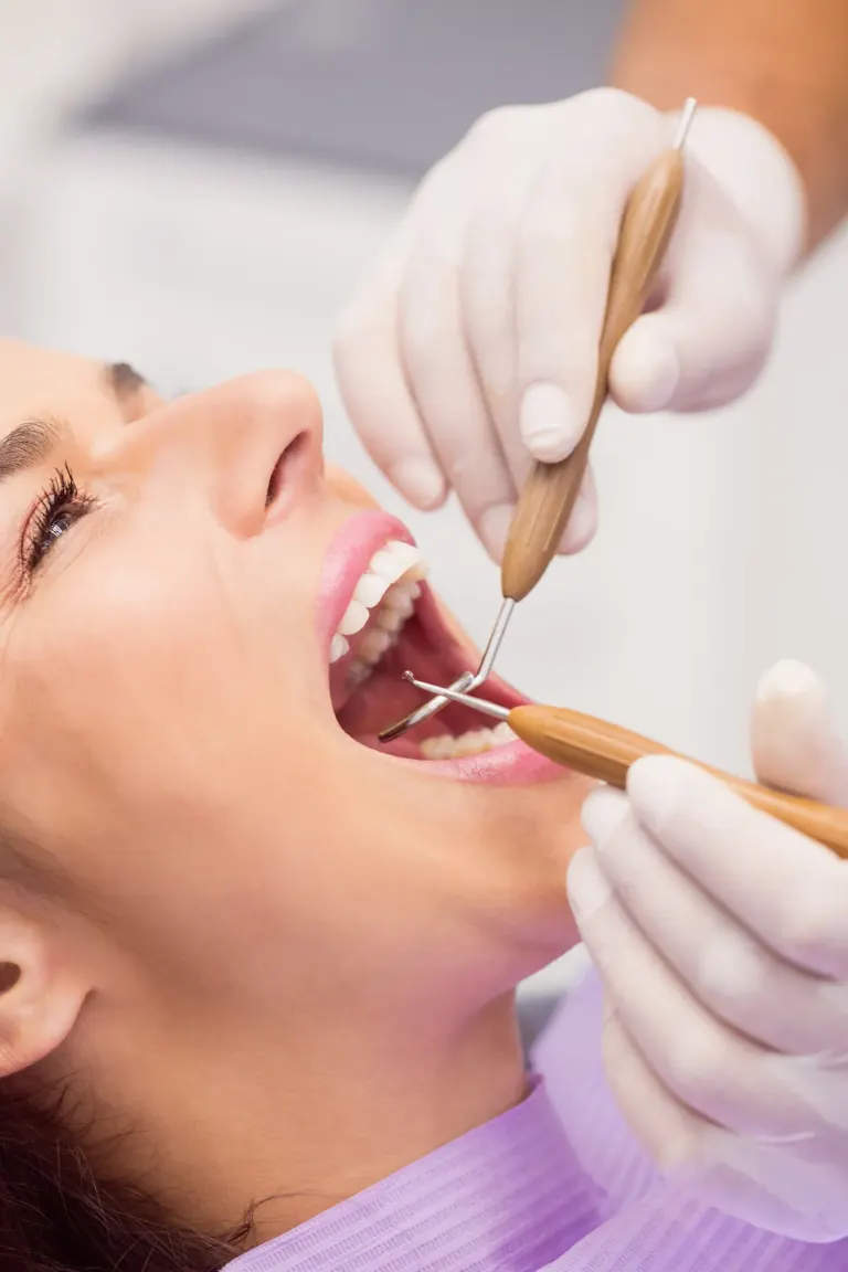 Before and after professional teeth cleaning comparison at Enclave Dental