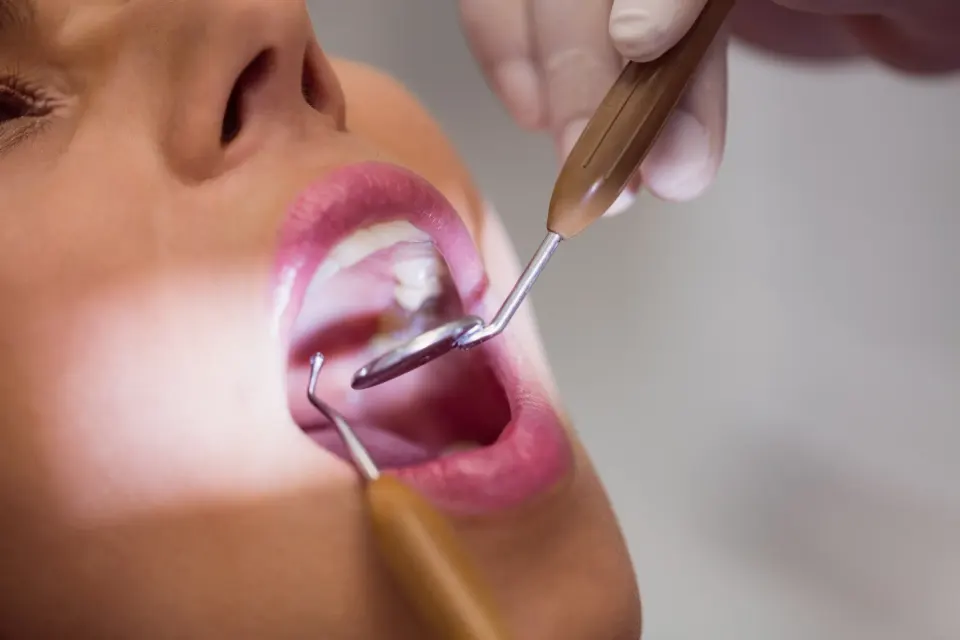 Dr. Shah placing a tooth-colored composite filling at Enclave Dental in Lake Mary, FL