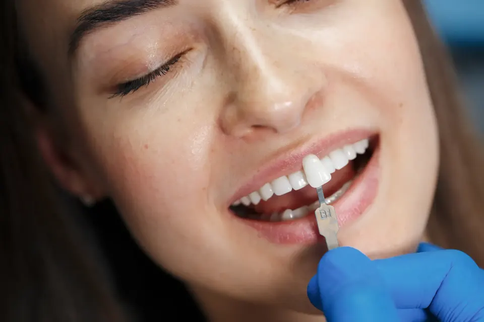 From Basic to Brilliant: Smile Design Dentistry That Works Like Magic