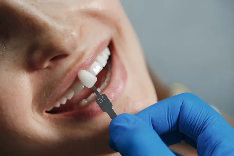Patient smiling after dental veneers treatment at Enclave Dental in Lake Mary FL