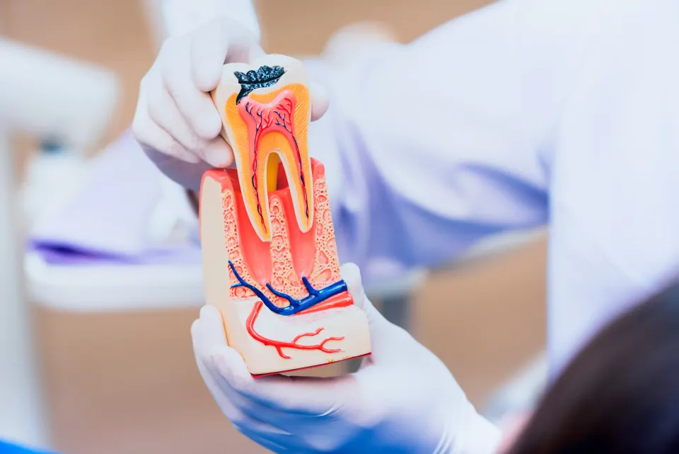 Myths About Root Canal Procedures
