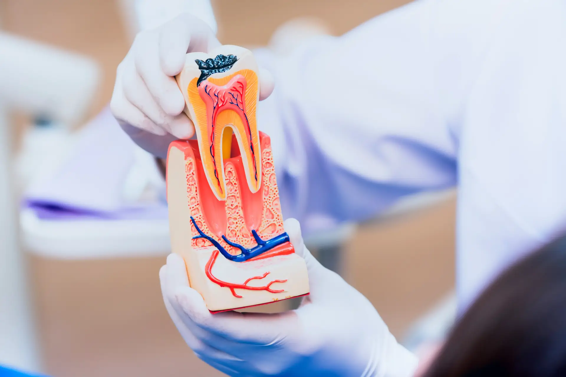 Myths About Root Canal Procedures