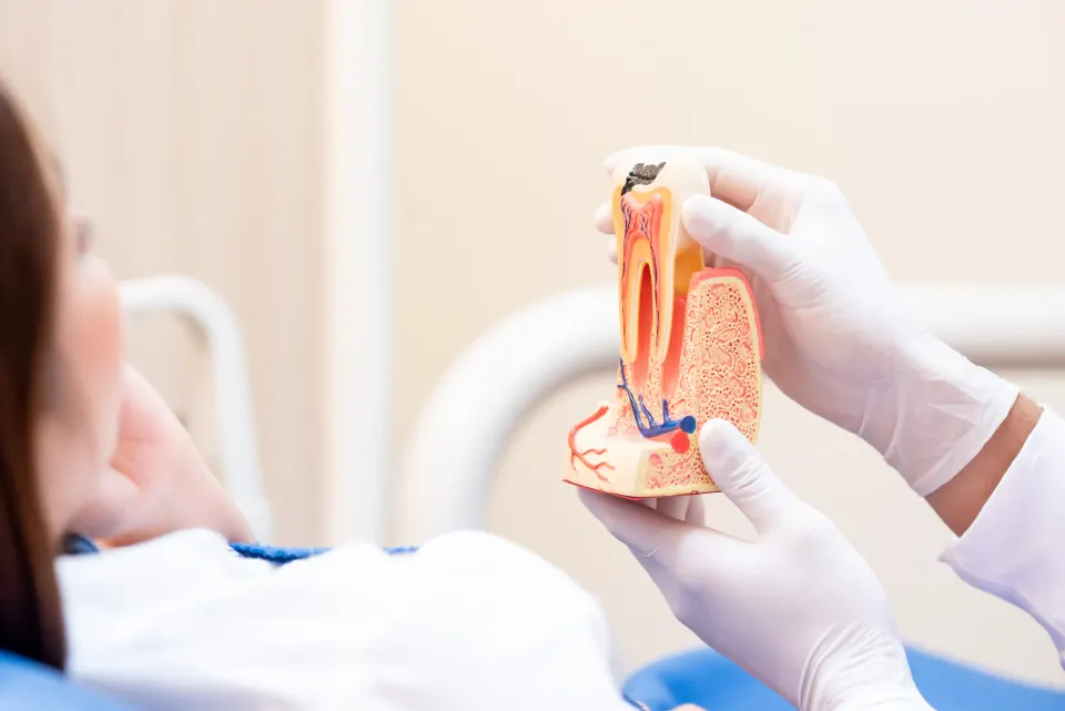 What Is a Root Canal Procedure and Why Is It Needed?