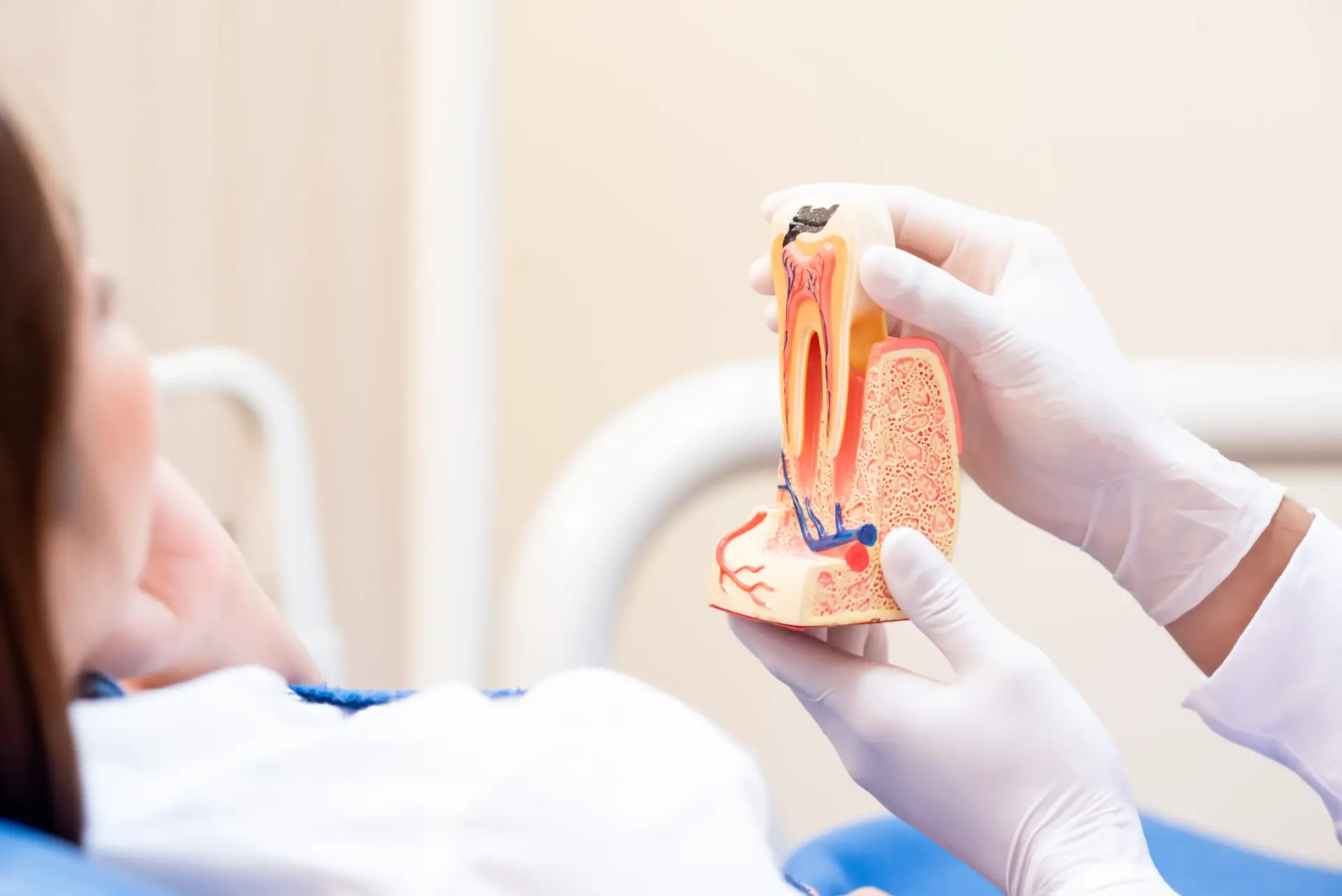 What Is a Root Canal Procedure and Why Is It Needed?