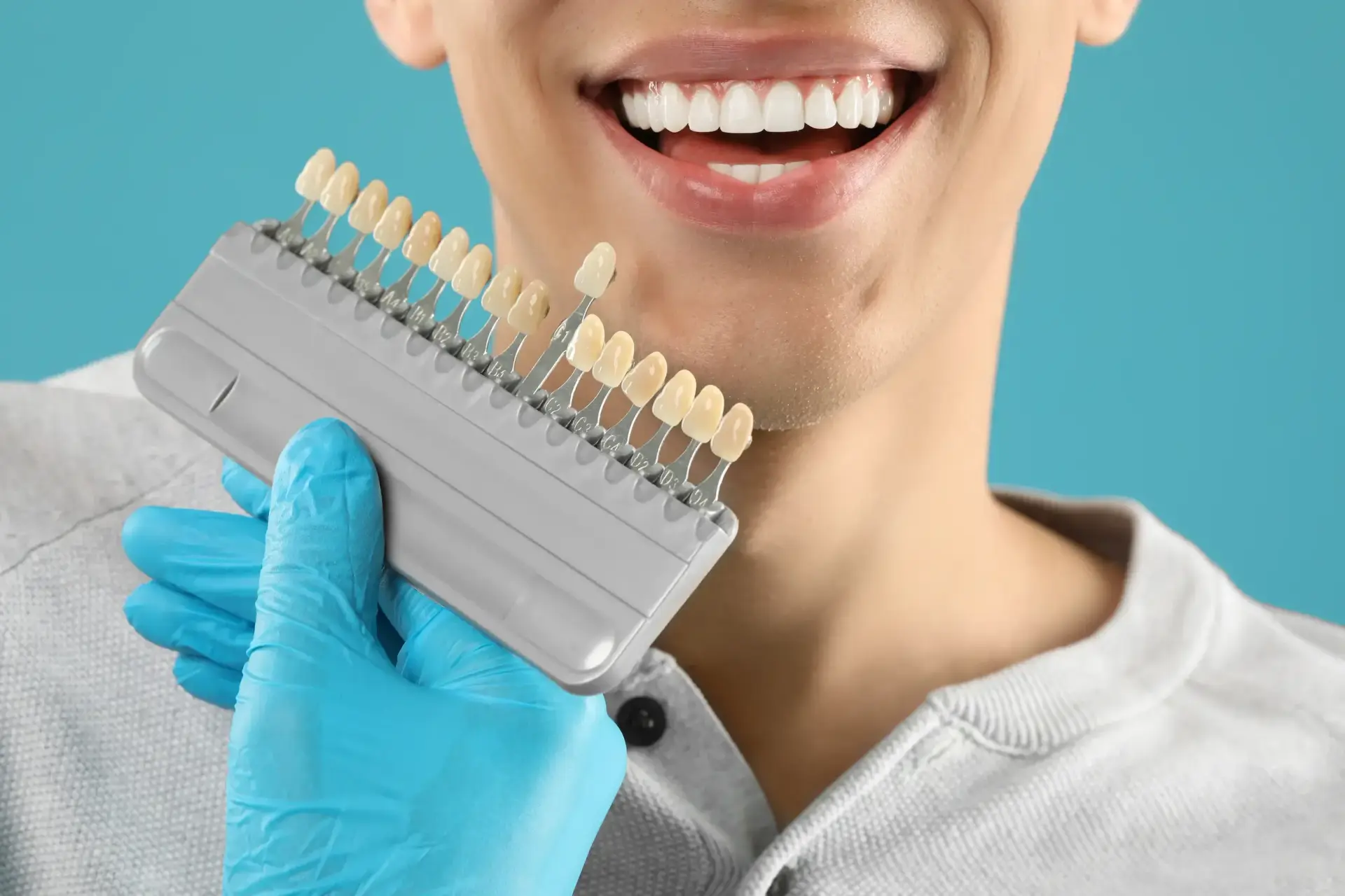 Is Teeth Whitening Safe for You? Lake Mary's Experts Weigh In