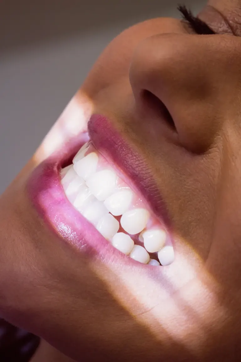 Before and after comparison showing teeth whitening transformation at Enclave Dental Lake Mary