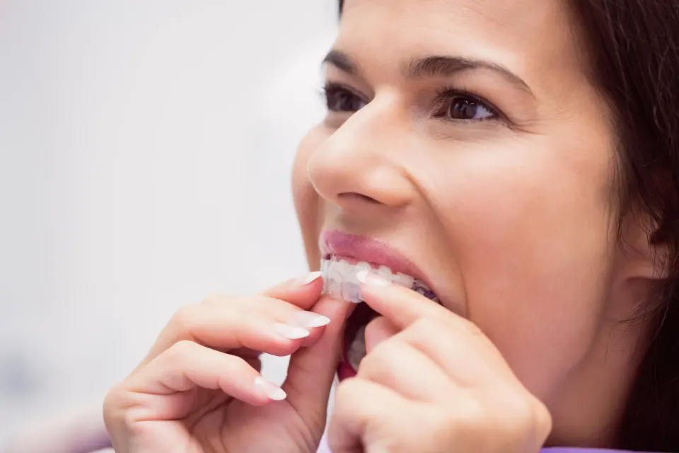 How Night Guards Protect Dental Work Like Crowns and Veneers