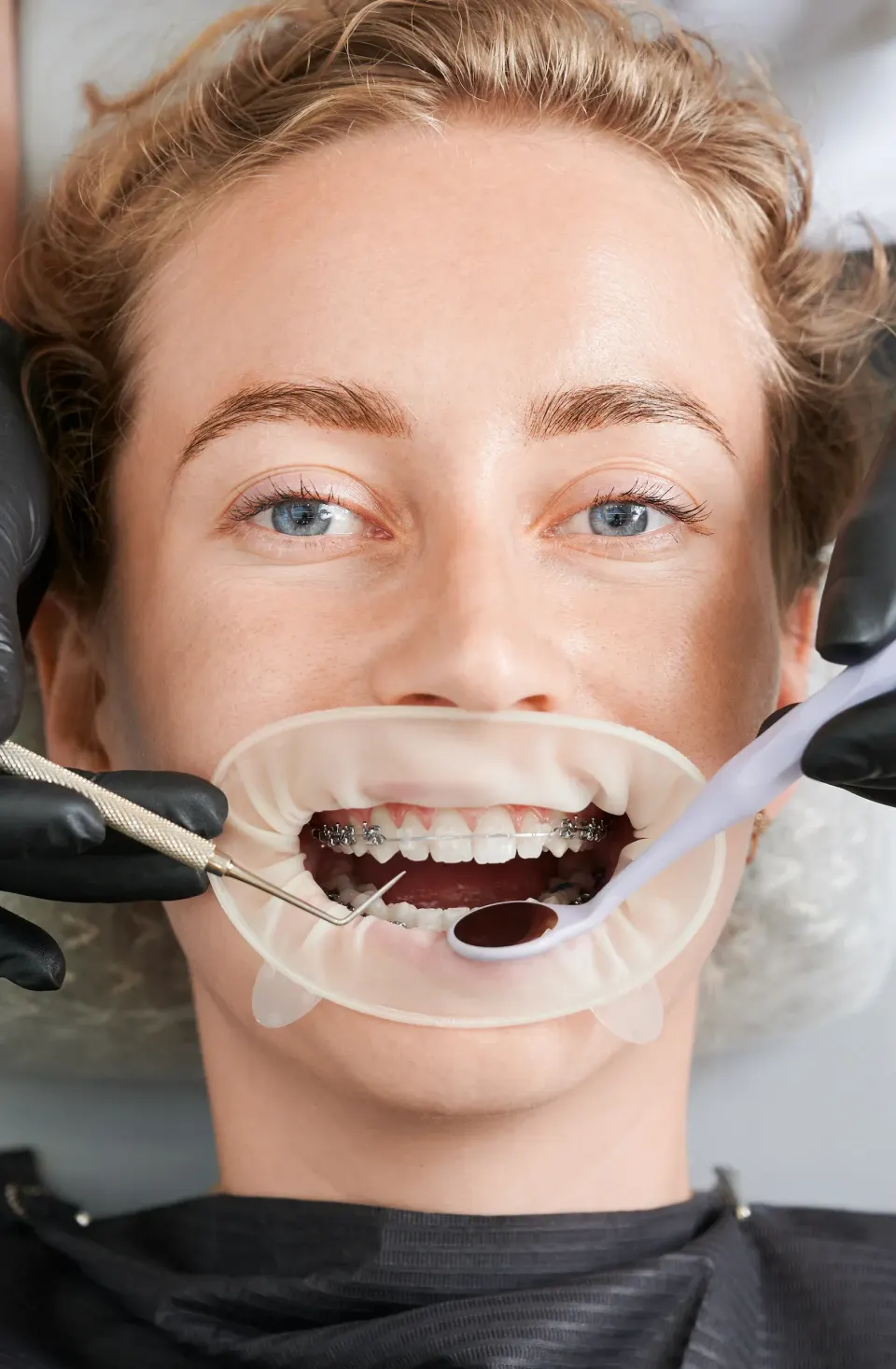Patient smiling after enameloplasty consultation at Enclave Dental Lake Mary FL