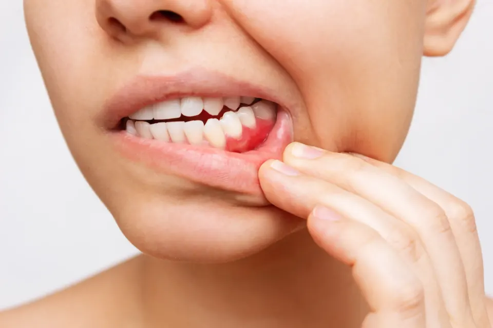 Key Insights for Dental Implants and Gum Health