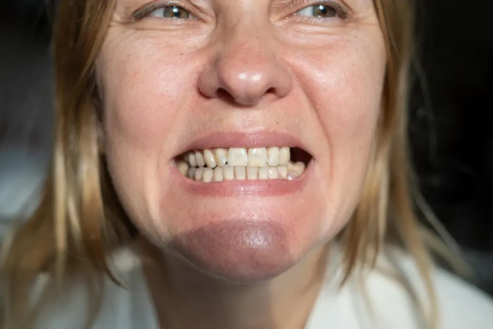 Visual showing different causes of tooth loss in adults