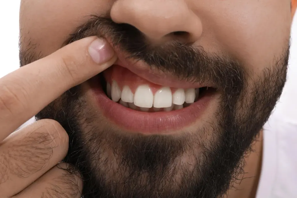 Dr. Shah performing a dental exam to evaluate the cause of a patient's tooth sensitivity