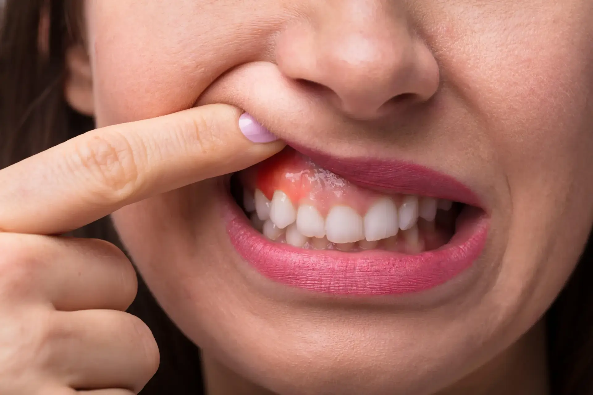 Patient discussing sensitive teeth with Dr. Shachi Shah at Enclave Dental in Lake Mary FL