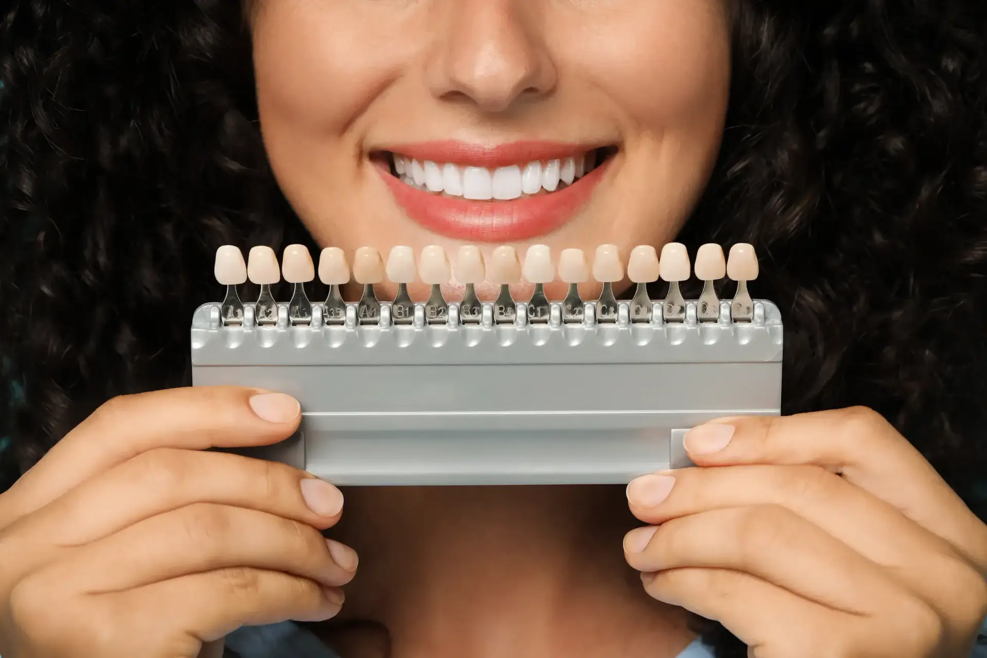 How Dental Veneers Instantly Improve Your Smile