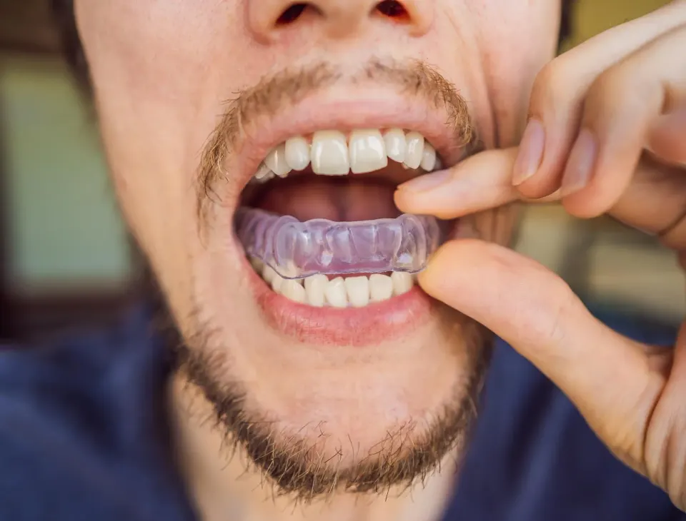 Stressed adult grinding teeth during sleep illustration