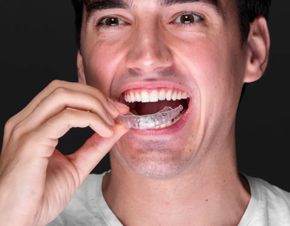 Close-up of worn teeth caused by bruxism