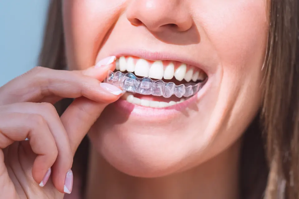 Managing Discomfort After What Happens During Invisalign Adjustments
