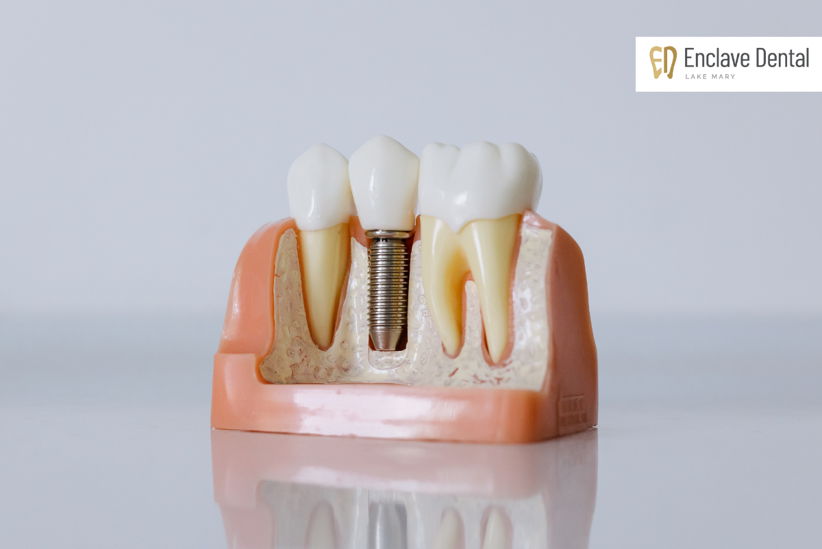 Gum Health And Dental Implants